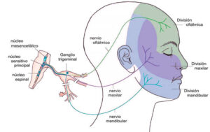 Diferencias cefalea y migraña